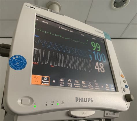 Optical vs chest strap heart rate monitors - Measuring beats per minute ...