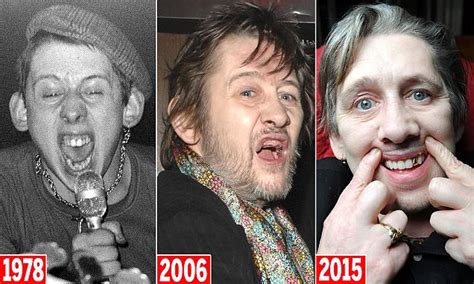 Pogues singer Shane MacGowan gets a full set of new gnashers including ...