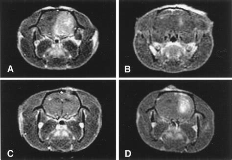 MRI coronal view of rat brains at the level of the largest lesion ...