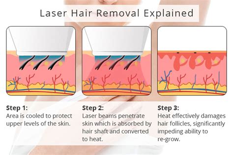 Laser Hair Removal Las Vegas, NV - Chic la Vie Med Spa