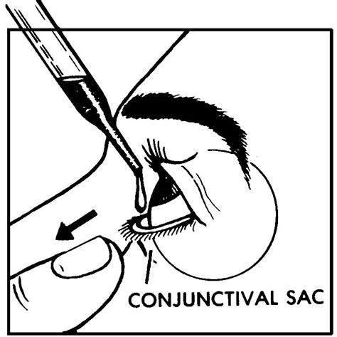 1-13. INSTILLING EYE DROPS OR OINTMENTS