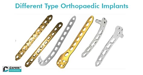 6 Different Types of Orthopaedic Implants and Their Insistent Demand in ...