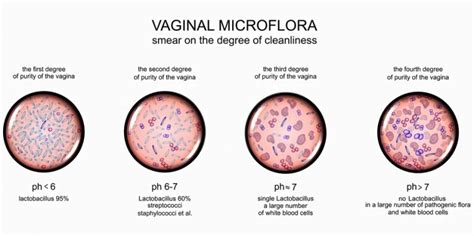 Gardnerella Vaginalis - The Definitive Guide | Biology Dictionary