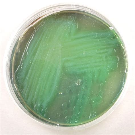 Pseudomonas aeruginosa - Microbiology - Medbullets Step 1