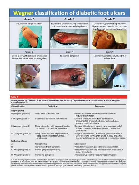 Diabetic foot wagner.docx