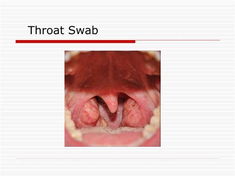 PPT - Sputum Culture and Throat Swab PowerPoint Presentation - ID:332967