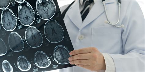 What a CT Scan Shows of the Head and Brain | American Health Imaging