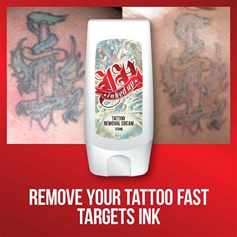 7 Best Tattoo Removal Creams to Erase Unwanted Tattoos & Memories