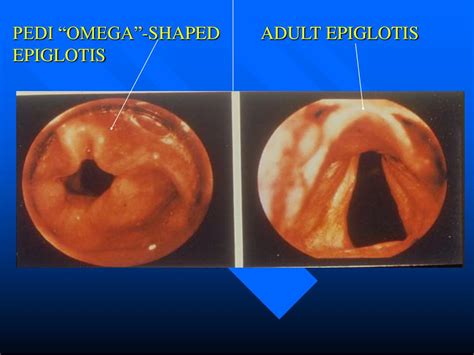 PPT - Neonatal Considerations Principles-II Juan E. Gonzalez, CRNA, MS ...