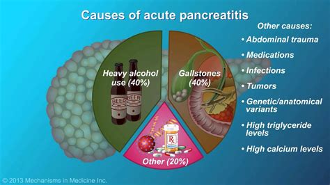 Acute Pancreatitis - YouTube