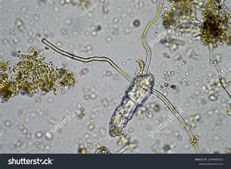 Soil Microorganisms Under Microscope Soil Life Stock Photo 2194680521 ...