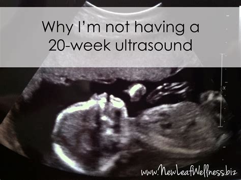 Why I’m skipping the 20-week ultrasound | The Family Freezer