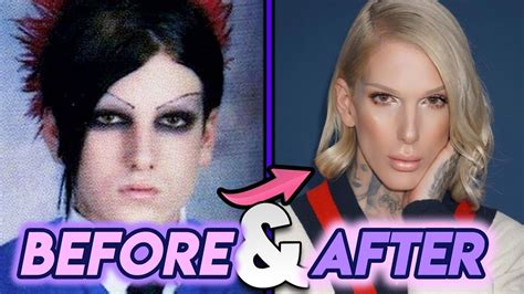 Jeffree Star Before Transformation