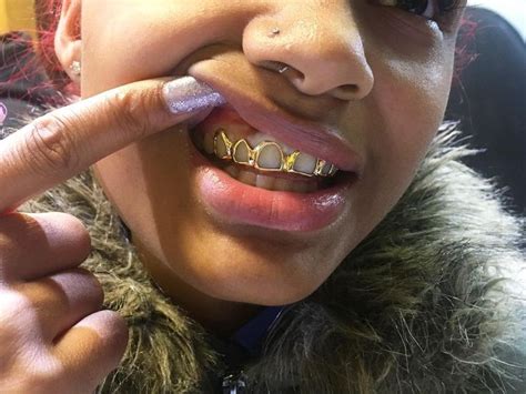 Gold Open Face Top Grillz For Girls | Gold teeth grills, Grills teeth ...