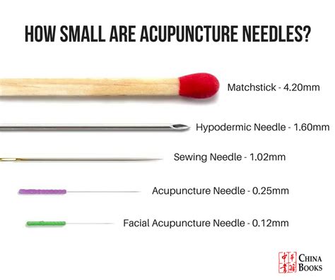 Why Acupuncture Doesn't Hurt - Health In Flow