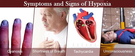 Symptoms Of Hypoxia In Elderly