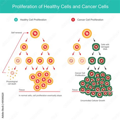 Vecteur Stock Proliferation of Healthy Cells and Cancer Cells ...