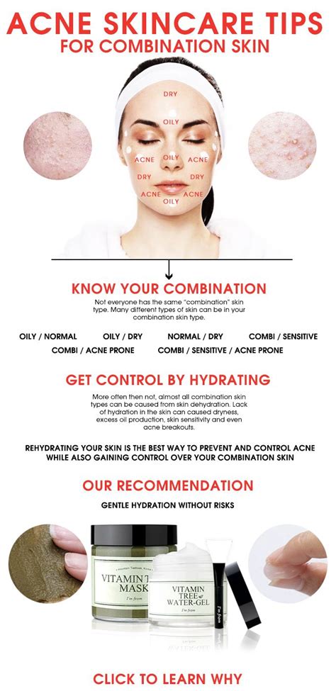 ACNE SKINCARE TIPS FOR COMBINATION SKIN - WISHTREND GLAM | Combination ...