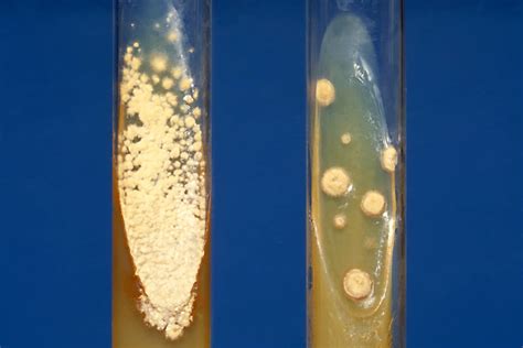 How to Perform an Agar Slant Culture Test for Fungal Infections