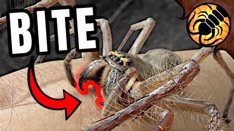 Huntsman Spider BITES ME! - YouTube