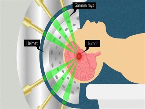 Gamma Rays Examples in Real Life – StudiousGuy