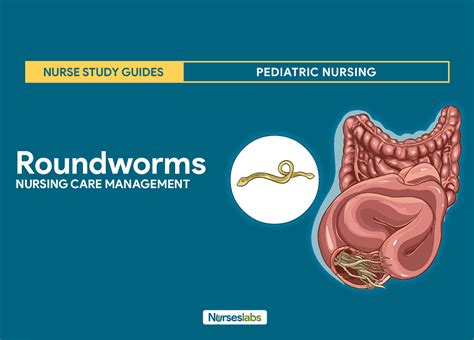 Roundworms (Ascariasis) Nursing Care Management: Study Guide | Nursing ...