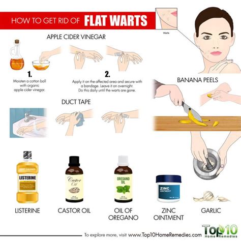 How to Get Rid of Flat Warts | Top 10 Home Remedies