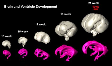 Neural - Ventricular System Development - Embryology