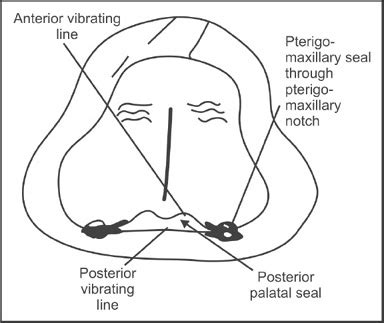 Posterior Palatal Seal Area Anatomy