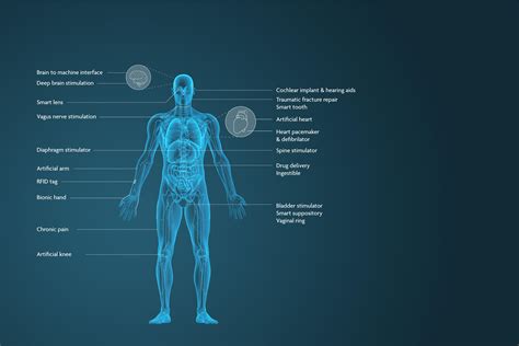 Medical Implant Market Size, Share Analysis, Key Companies, and...