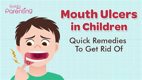 Blisters On Toddlers Lips And Tongue | Lipstutorial.org