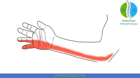 Ulnar Nerve Sensory Distribution