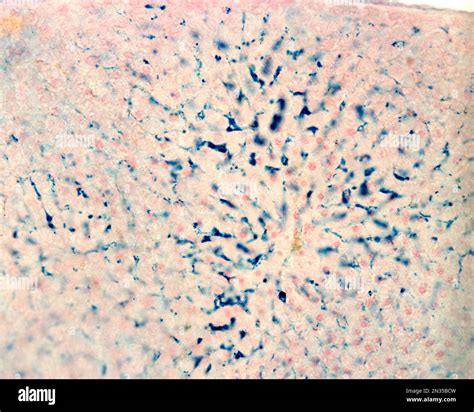 Kupffer cells are macrophages of the liver. Colloidal iron acts as a ...