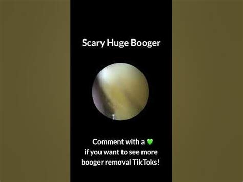 Huge Booger Removal - YouTube