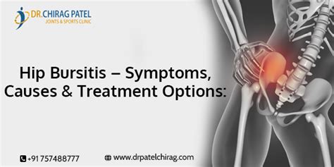 Hip Bursitis – Symptoms, Causes & Treatment Options: | Dr Chirag Patel