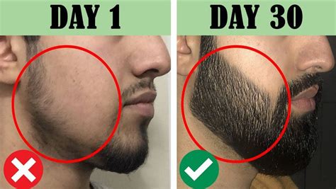 How to grow beard naturally at home | Grow beard, Beard, Beard oil