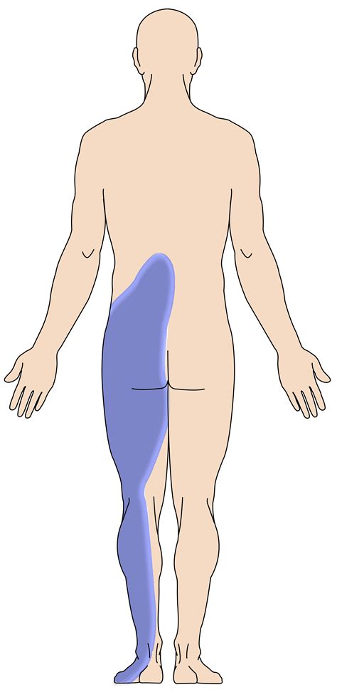 Lumbar Back Pain Into Legs