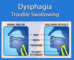 Pass The OT – DYSPHAGIA