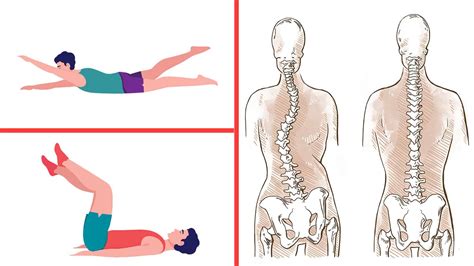 4 Exercises For People With Scoliosis - Divine Magazine