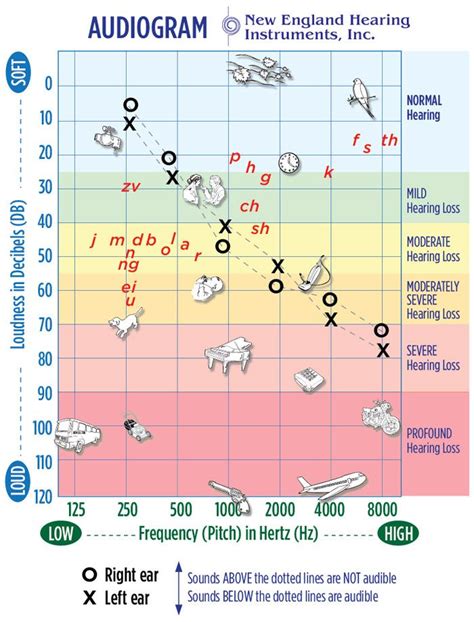 Audiogram Chart Templates