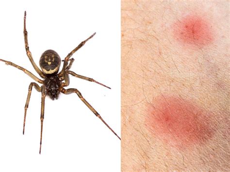 what does a spider bite look like - what does a spider bite look like