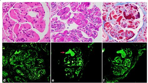 Light and immunofluorescence microscopy images: a. H&E section showing ...