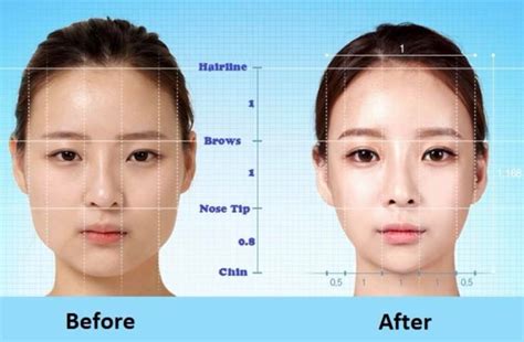 Facial Balancing and what it Means – northernrosemedspa