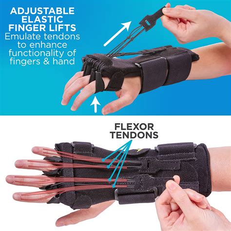 BraceAbility Radial Nerve Palsy Splint - Dynamic Wrist Drop and Limp ...