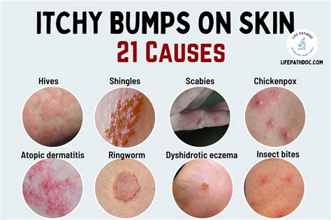 What Causes Small Itchy Bumps On Skin - Printable Templates Free