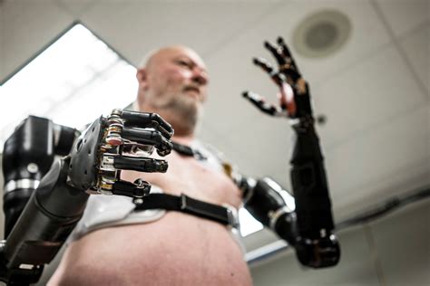 Robotic Human Arm Implantations