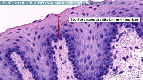 Stratified Squamous Epithelium | Overview, Function & Location - Lesson ...