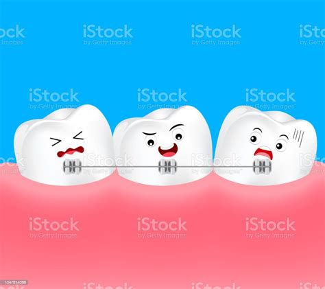 Cute Cartoon Teeth Braces Stock Illustration - Download Image Now ...