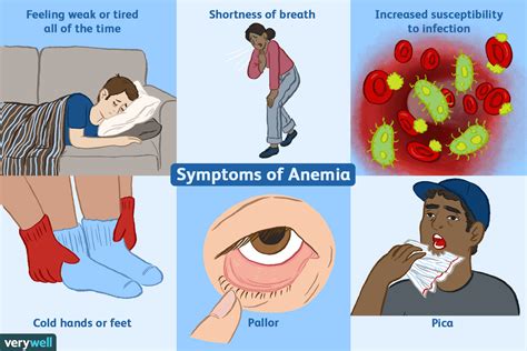 Anemia causes and methods of prevention | healthy care - healthy care