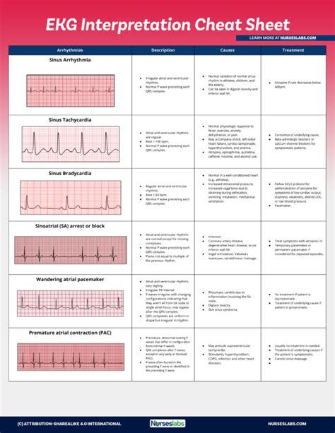 Ekg interpretation cheat sheet free download – Artofit